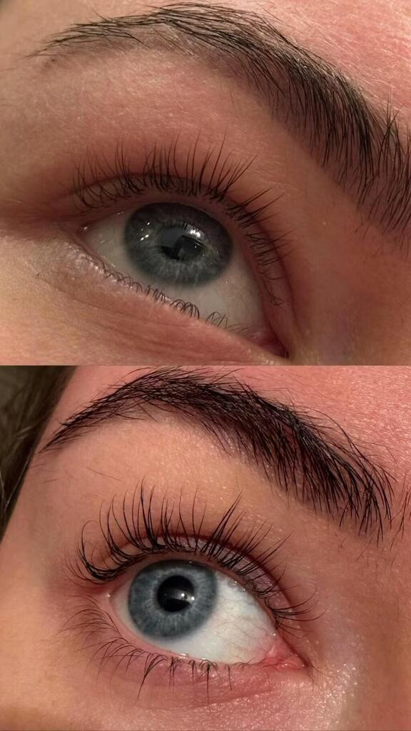 Nuo klausimo iki proveržio: kaip gimė LÍVLY blakstienų serumo sėkmės istorija